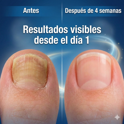 NailRenew™ — Aclara, Suaviza e Hidrata Tus Uñas Mientras Duermes